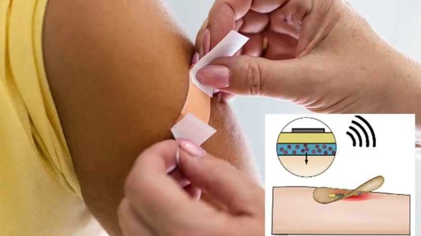 Băng y tế thông minh giúp chữa lành vết thương nhanh hơn 25%