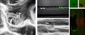 nanorobot dieu tri sau rang